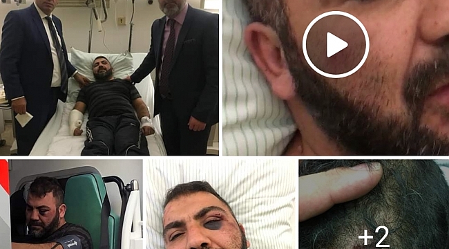 Alman polisinden gurbetçiye görülmemiş işkence - öldüresiye dövdüler sokağa bıraktıkar.
