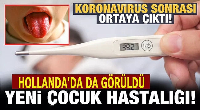 Yeni çocuk hastalığı Hollanda'da da görüldü