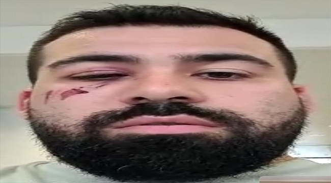 AK Parti'li Sırakaya'dan Alman polisinin darbettiği Ercan Tümer ile ilgili açıklama: