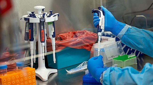 Maymun çiçeği hastalığına ilişkin merak edilen 11 soru ve  yanıtı