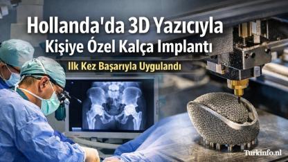 Hollanda’da 3D Yazıcıyla Kişiye Özel Kalça İmplantı Kullanıldı